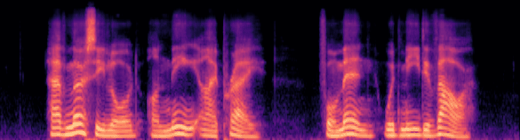 log-mel spectrogram